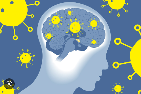 Covid Vaccine Causing Strokes - POS Pfizer Vaccine Injury - January 13, 2023